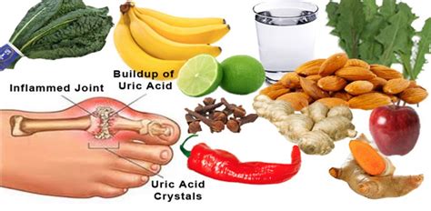 what is uric acid in the body.